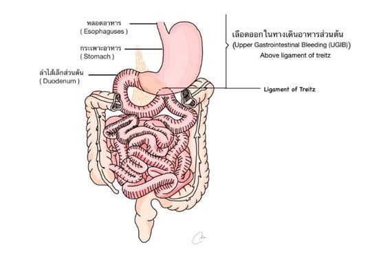 Upper gastrointestinal (GI) 