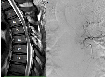 [TJS 46-2 05] Figure 3