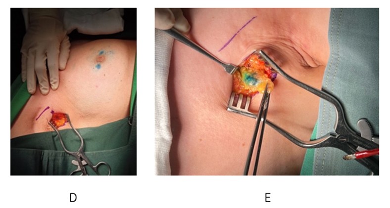 [TJS 46-2] 02 Figure 2 Seperate incisions