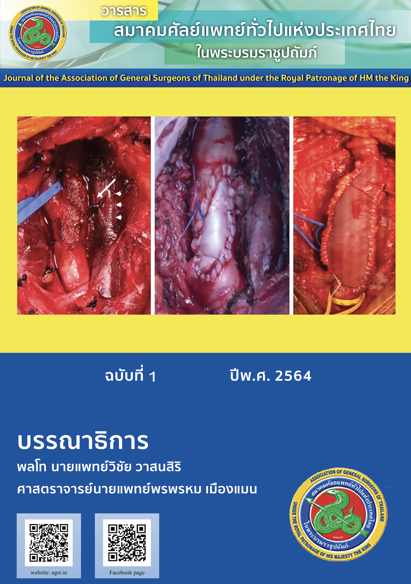 					View Vol. 6 No. 1 (2021): Journal of the Association of General Surgeons of Thailand under the Royal of Patronage of HM the King  1/2021
				