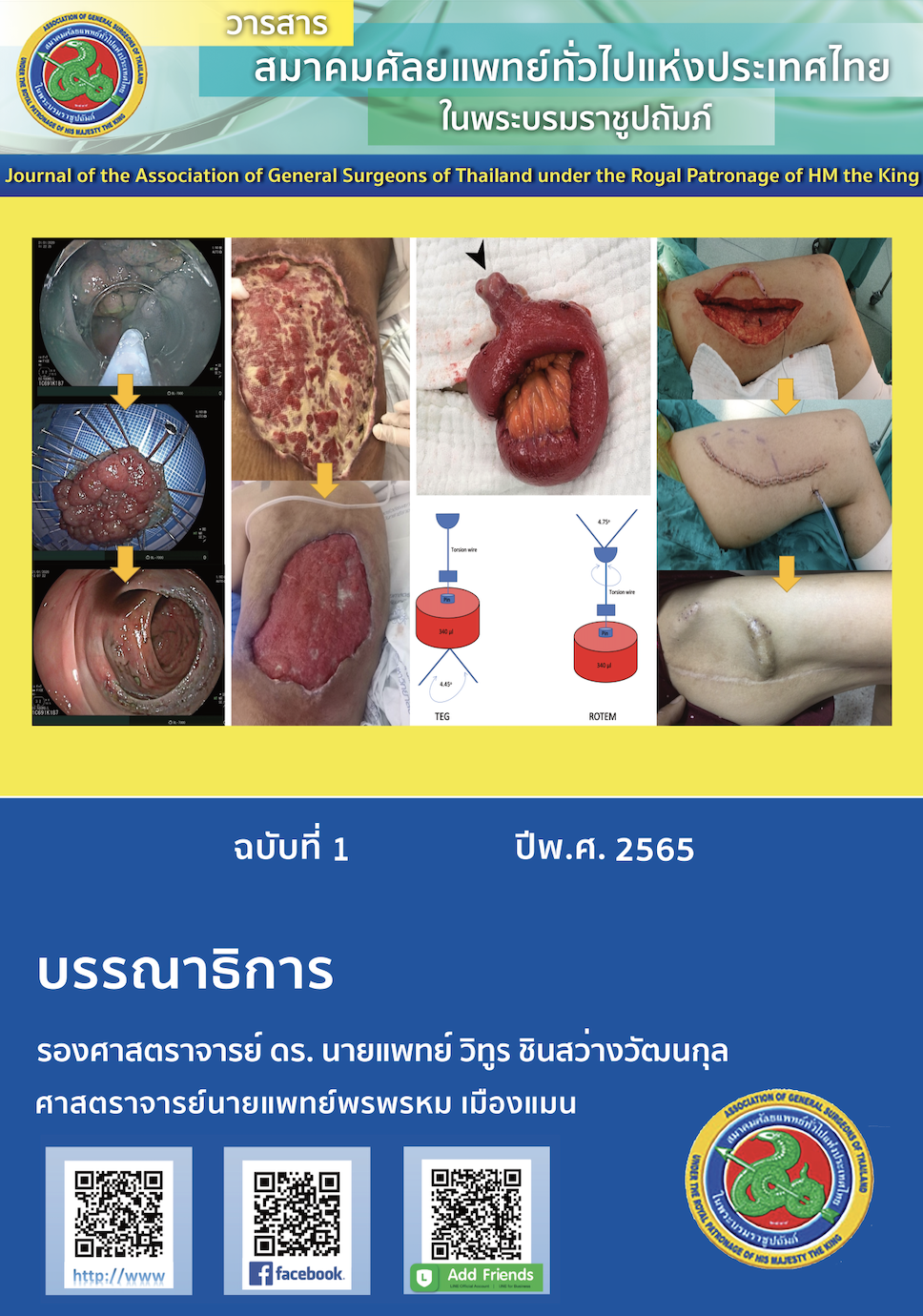 					View Vol. 7 No. 1 (2022): Journal of the Association of General Surgeons of Thailand under the Royal of Patronage of HM the King  1/2022
				