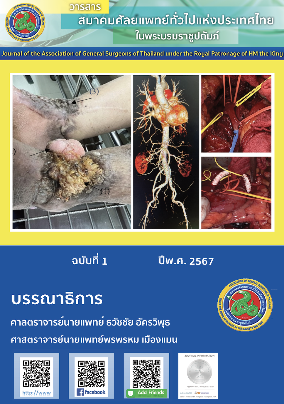 					View Vol. 9 No. 1 (2024): Journal of the Association of General Surgeons of Thailand under the Royal of Patronage of HM the King 1/2024	2024-02-21
				